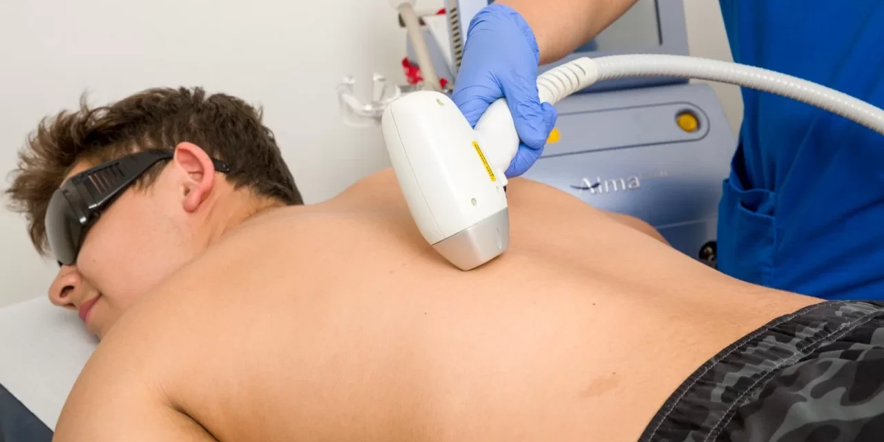 Depilaciones laser todo lo que necesitas saber Depilaciones laser todo lo que necesitas saber