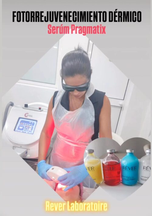 Fototerapia con IPL carbono activo